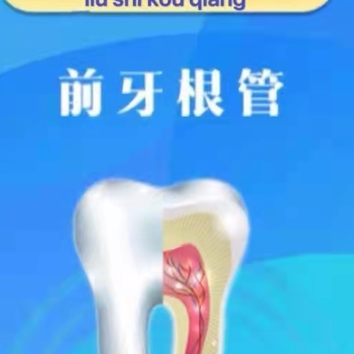 【根管治疗前牙】前牙根管治疗