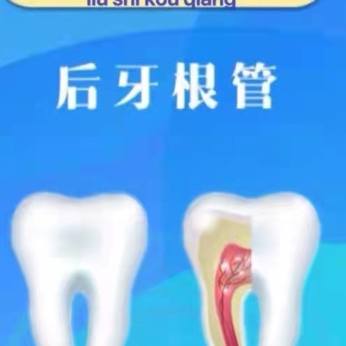 【根管治疗后磨牙】后牙根管治疗