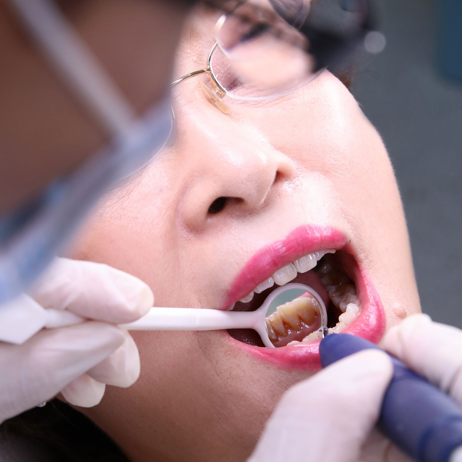 EELHOE 补牙套装 临时补牙材料缺牙断牙牙缝牙洞修补可塑性牙胶-阿里巴巴