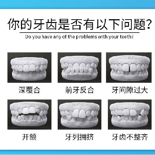 【牙齿矫正MBT矫正（陶瓷）】【牙齿前突、牙齿拥挤、牙齿不齐】陶瓷矫正