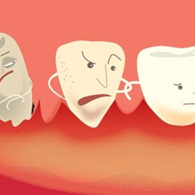 为什么牙缝越来越大，90%的人都选择错了治疗方式！