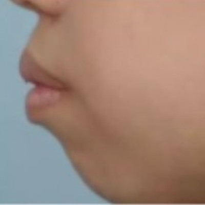 广州全家福口腔怎么样？整牙贵不贵？