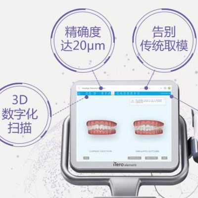 介绍3D牙齿矫正技术全过程,矫正优点,多少钱可以做!