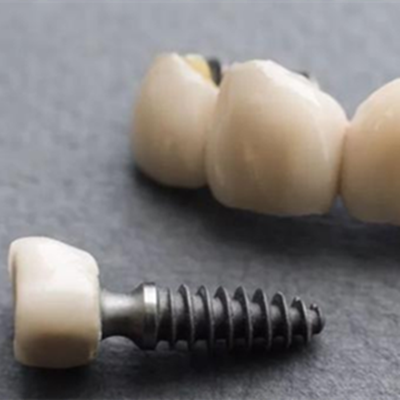 为什么说牙医不建议亲属种牙 种植牙有危害吗 做完后悔吗