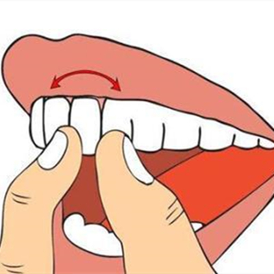 牙齿松动是什么原因？到底该怎么治好看看这个办法！