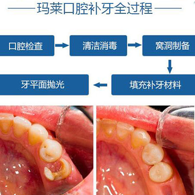 东莞常平牙科哪里比较好？整牙正规效果好的医院有几家？