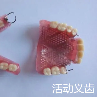老人满口牙都缺了怎么办?重庆老人缺牙有三种修复方法价格!