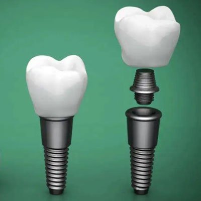 泰安种植牙医院排名分享，都是种牙技术好还便宜的牙科！