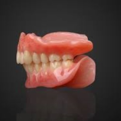 缺牙修复有几种方法？种植、烤瓷、义齿适用广泛
