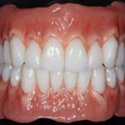 吸附性义齿和普通义齿的区别？四个区别让你了解两者不同