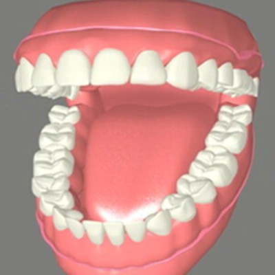 什么是bps吸附性义齿？其优劣势有哪些？大揭秘