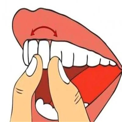 重度牙周炎还能治好吗?有治疗的必要吗?一分钟带你了解!