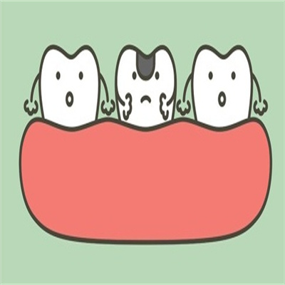 牙齿烂了个洞长期不补会怎样?详细解析会带来的弊端有哪些!