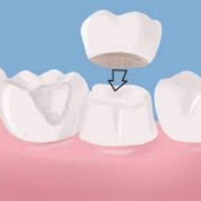 泸县看牙的地方并不少，尤其是这三家口腔医院值得推荐！