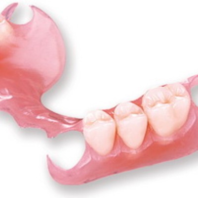 牙齿缺失后三种修复方式，应该选哪种进行修复？