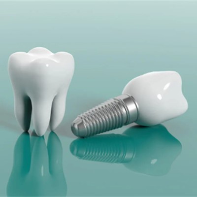 营口口腔医院哪家种植牙比较好,大概多少钱有哪位老铁知道?