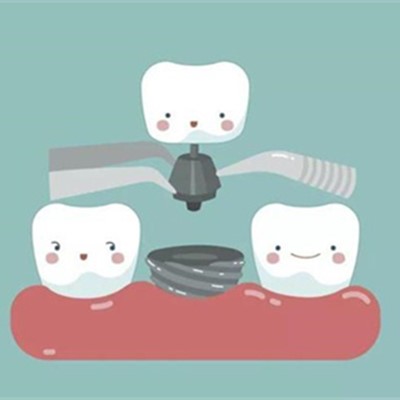 汉口区种植牙医院排名榜单新鲜出炉,均为正规靠谱种牙口腔!