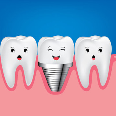 在兰州诺贝尔口腔做种植牙是什么的体验？分享看牙过程