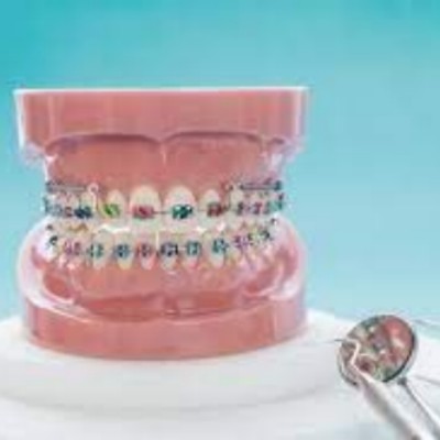 同步口腔活动优惠力度大，种植牙/矫正/补牙/修复有补贴！
