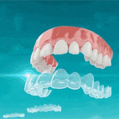 嘉兴口腔正畸排名指南：牙齿矫正哪家好，整牙找哪个牙科快速了解