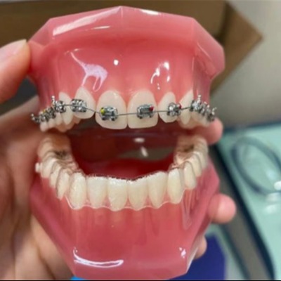 宁波牙齿矫正好的正规口腔医院排名分享！都是在当地有名的